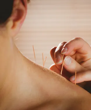 Acupuncture & Meridian Therapy
